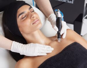 Hydrafacial Body Decollete