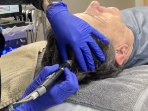 HydraScalp Treatment Pic